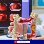 La pérdida de esta proteína podría provocar cáncer de colon